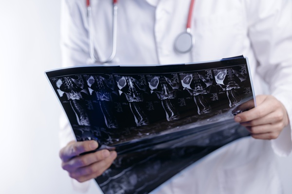 Minimally Invasive Treatments From A Neurosurgeon