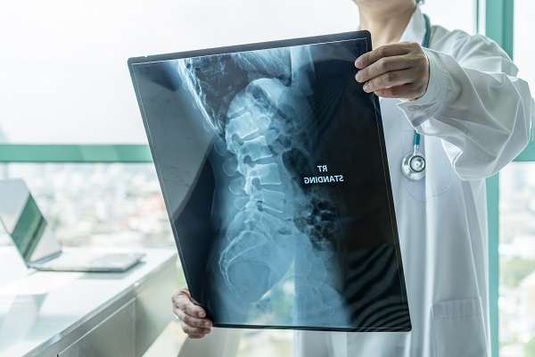 Spinal Tumor Treatment Options